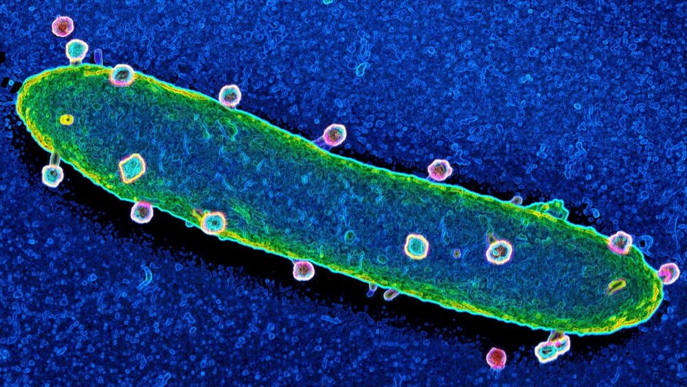 Spezifische Bakteriophagen binden fest an Bakterienoberfläche. Foto: Manfred Rohde.