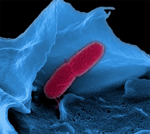 Anheftung einer Bakterienzelle (rot) an menschliche Darmzelle. Foto: Hubert Mayer.
