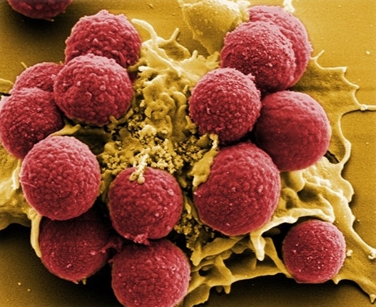 Aufnahme von Sporen eines pathogenen Schimmelpilzes (Aspergillus fumigatus) (rot) durch Makrophagen(gelb). Foto: Manfred Rohde.